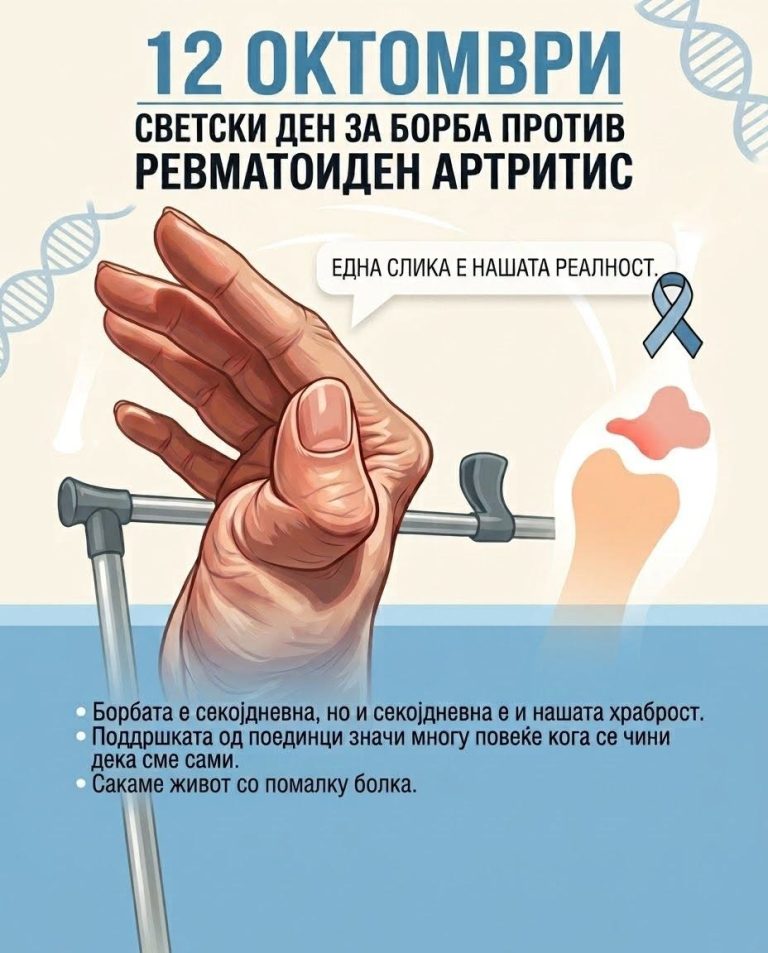 Светски ден за борба против артритисот: Не сум мрзлива. Живеам со болка што не се гледа.